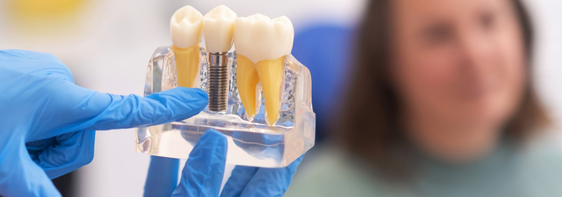 Zahnarzt Nürnberg erklärt einer Patientin den Aufbau eines Implantats anhand eines Zahnmodells