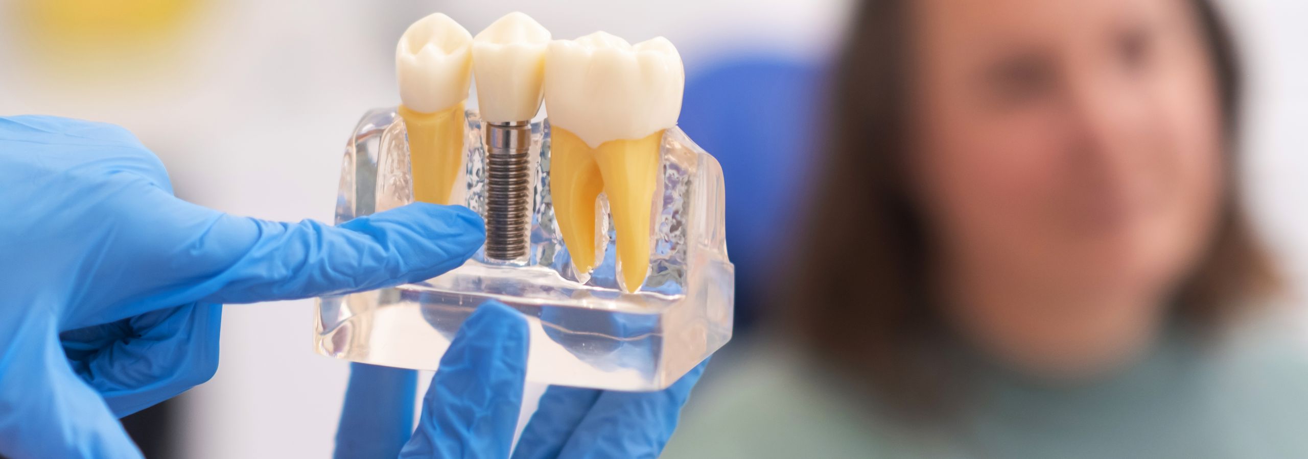 Zahnarzt Nürnberg erklärt einer Patientin den Aufbau eines Implantats anhand eines Zahnmodells